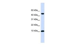 ZNF706 Rabbit anti-Human, Polyclonal, Novus Biologicals 100 &mu;g | Buy Online | Novus Biologicals | Fisher Scientific